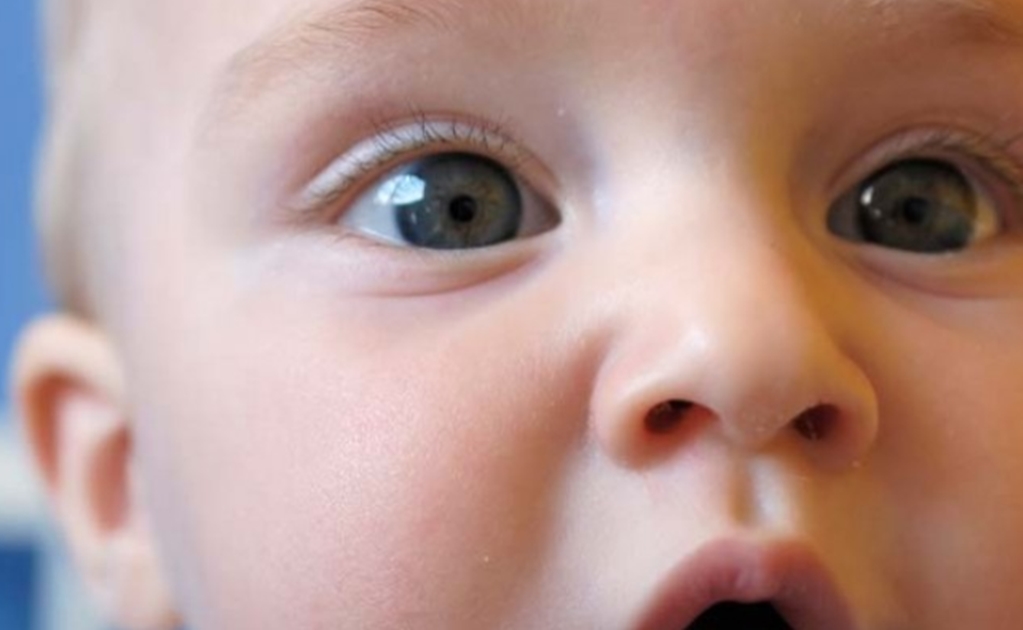 patologias congenitas ciudad de el Alto Bolivia